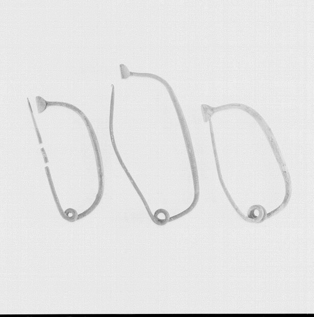 fibula/ ad arco ribassato