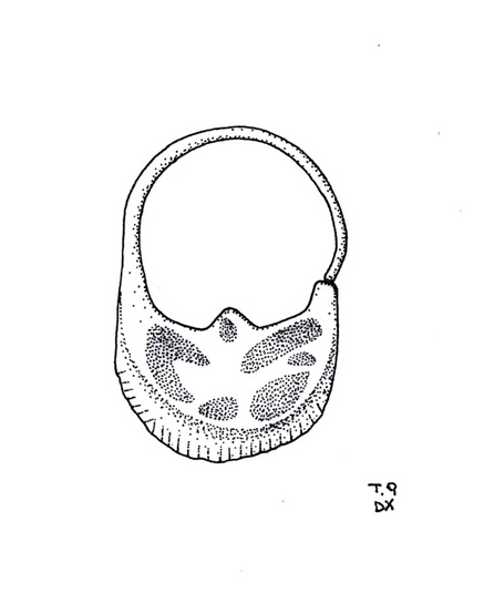 cerchietto temporale/ a lunetta