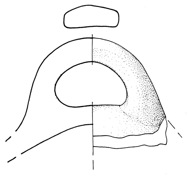 coperchio
